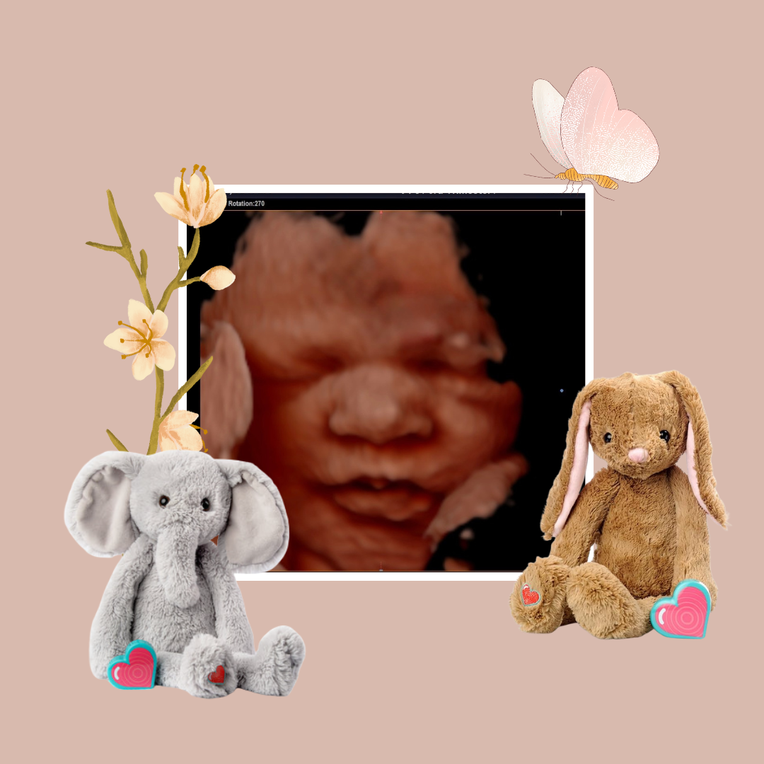3D/4D/HD Meet your Baby Bud Premium Ultrasound (Includes Plush Heartbeat Animal)