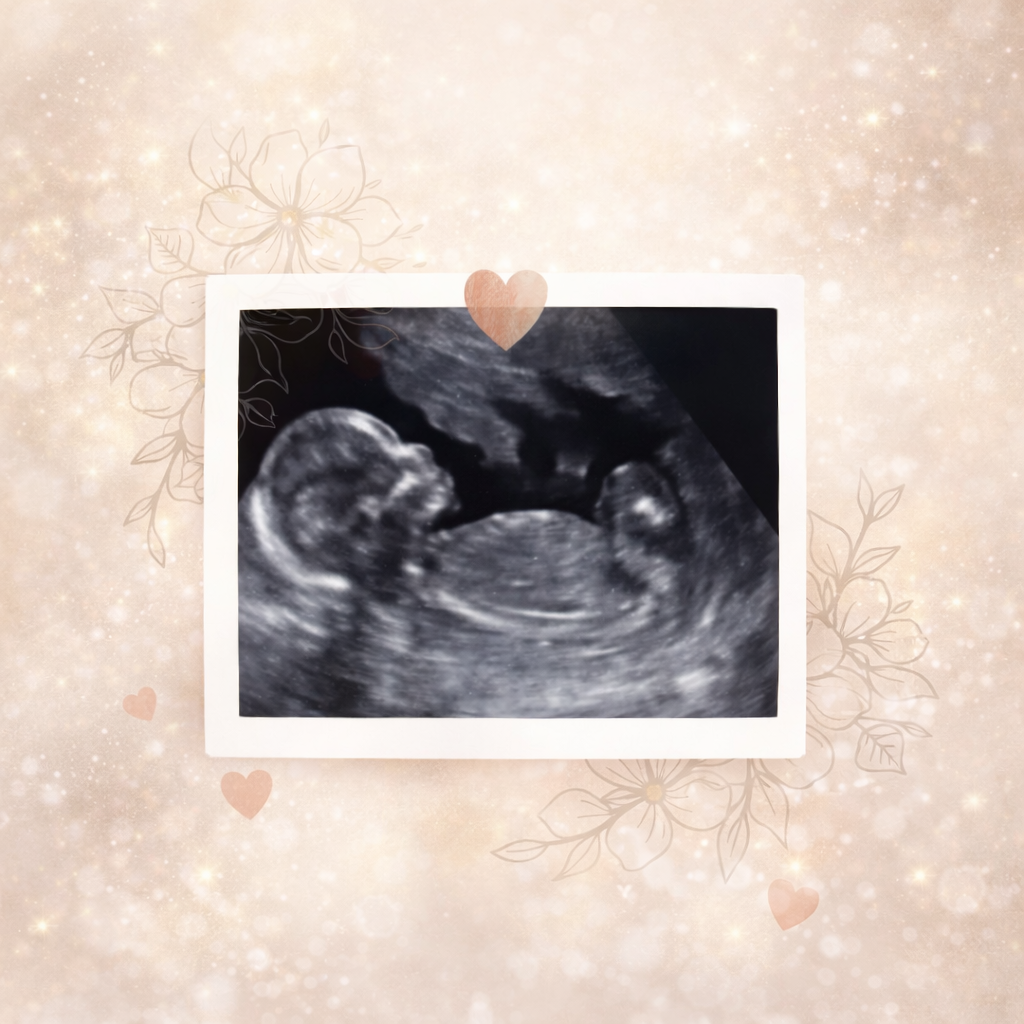 Sweet View 2D Ultrasound