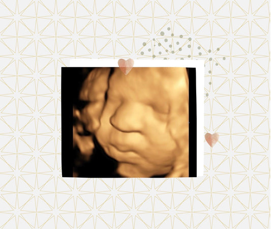 Signature Baby Bud 3D/4D Ultrasound Package