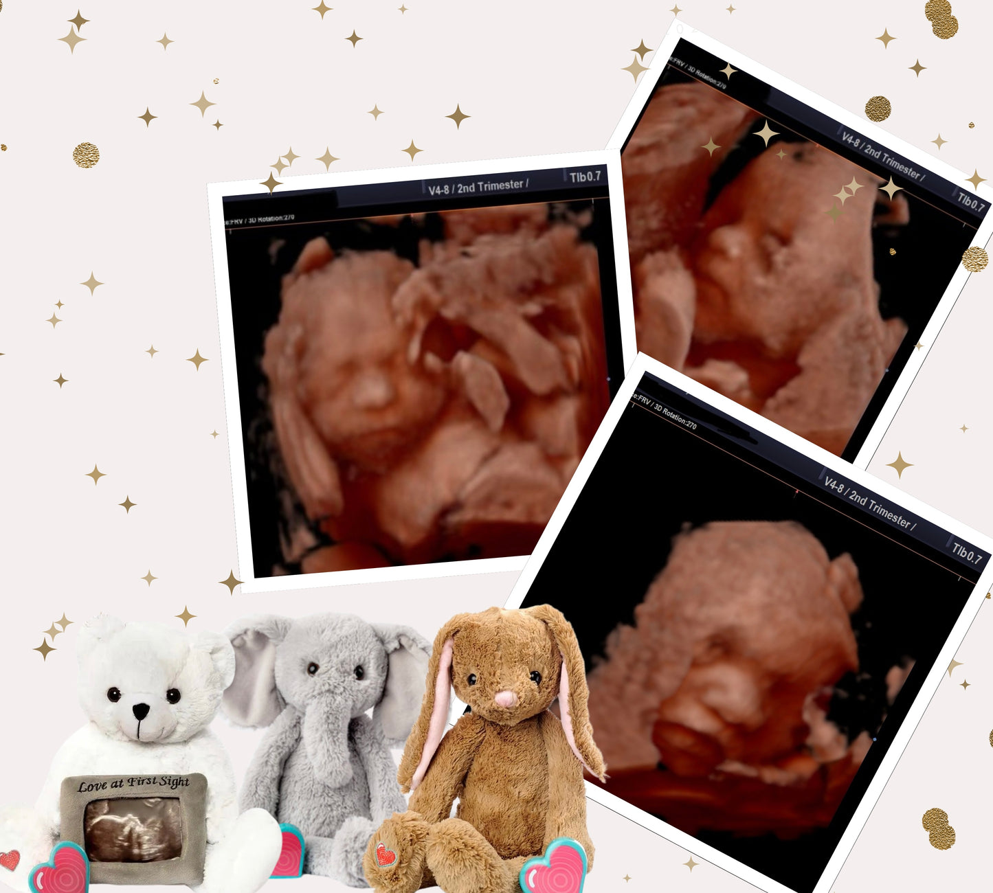 3D/4D/HD Meet your Baby Bud Premium Ultrasound (Includes Plush Heartbeat Animal)