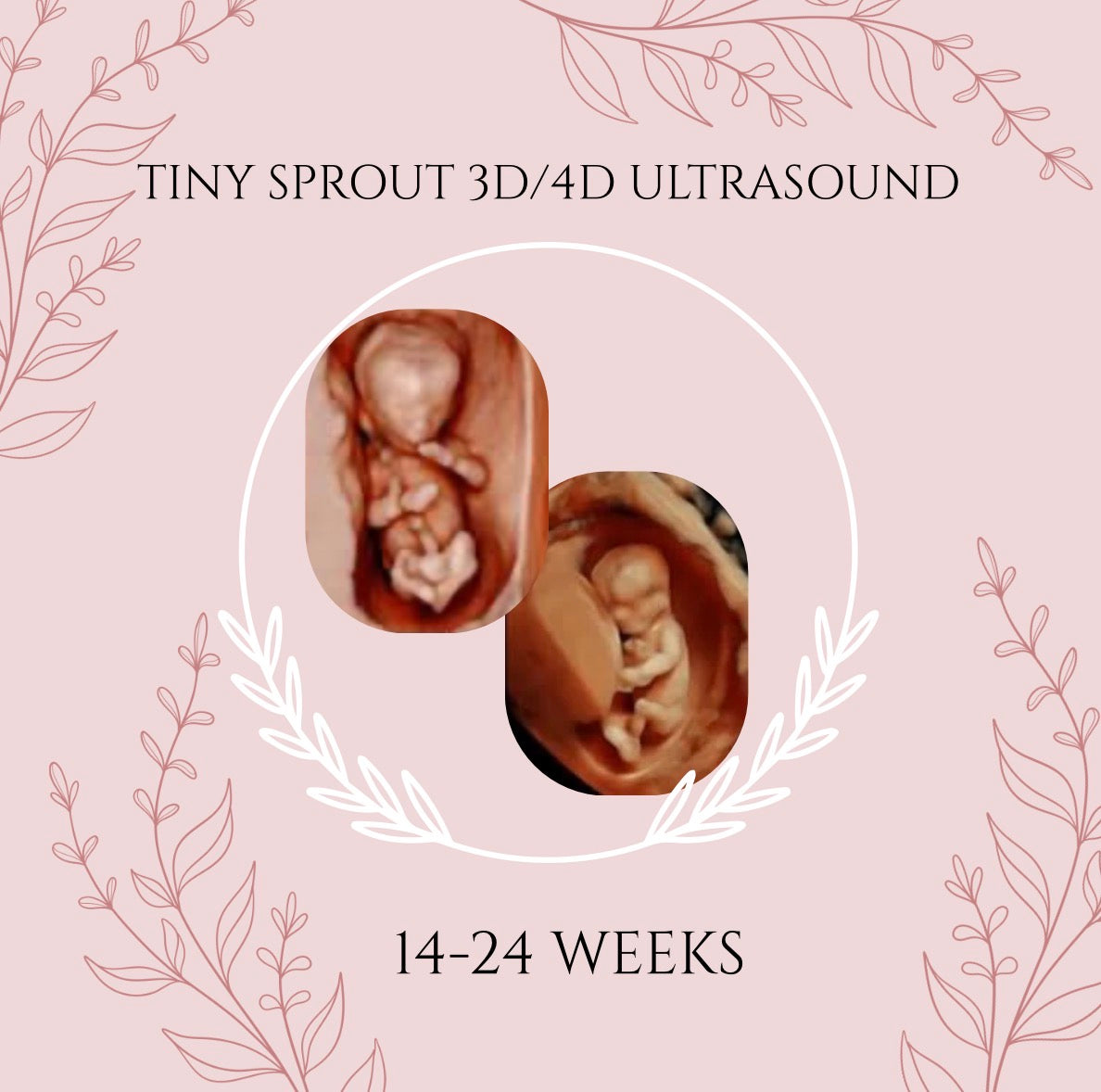 Tiny Sprout 3D/4D Ultrasound (14-24 weeks)