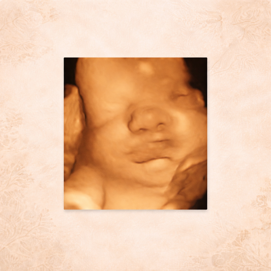 Signature Baby Bud 3D/4D Ultrasound Package